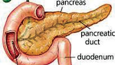 Photo of Pancreatitis