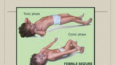 Photo of Febrile Seizures in Children